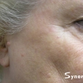 A close-up image showing a woman's clear, sunspot-free cheek after an IPL Photo Facial treatment at Calista Skin and Laser Center.
