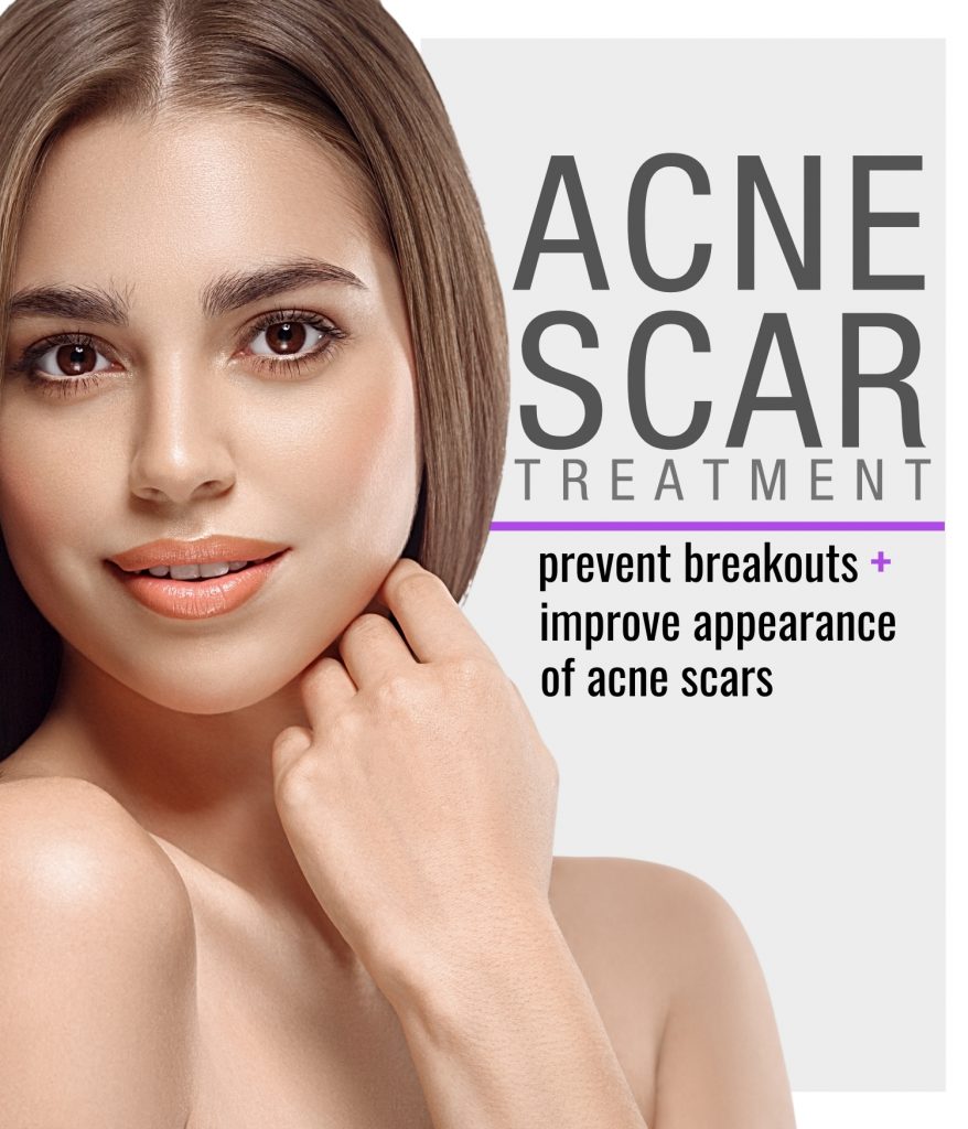 Woman's clear skin from Acne Scar Treatment.