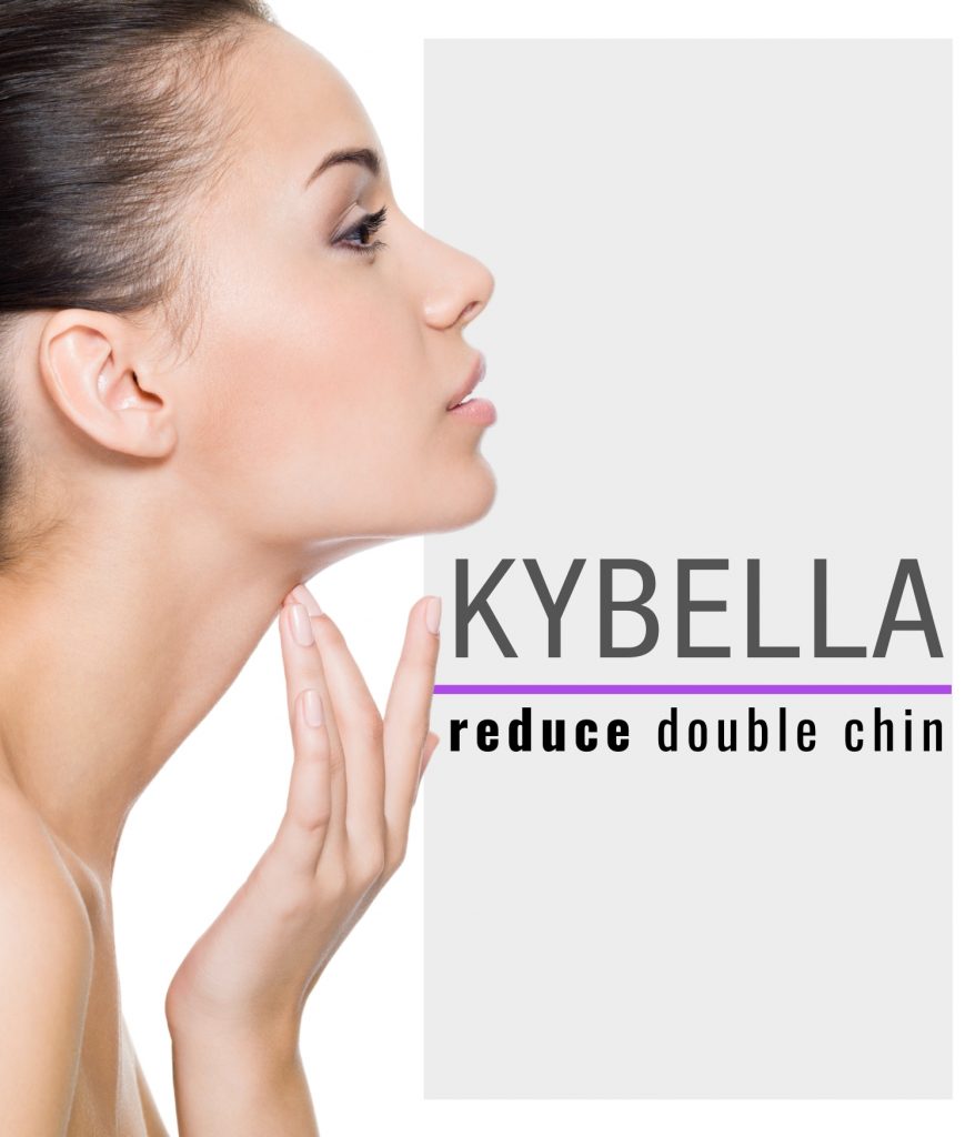 Woman touching her chin after Kybella treatment.