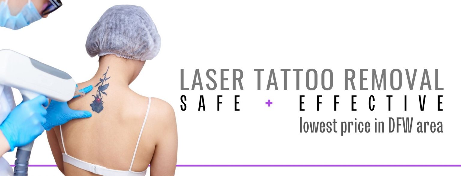 Laser Tattoo Removal DallasFort Worth