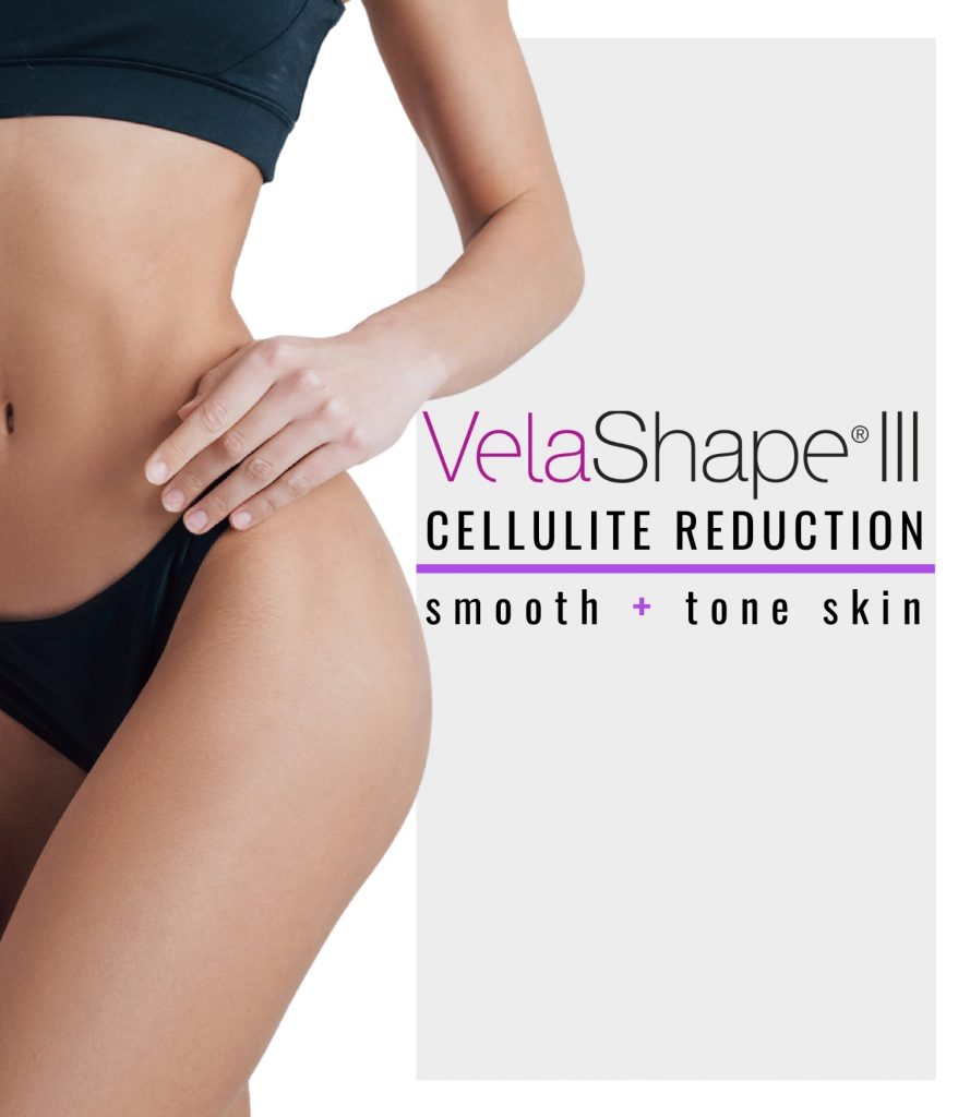Woman's smooth and toned legs results from VelaShape.