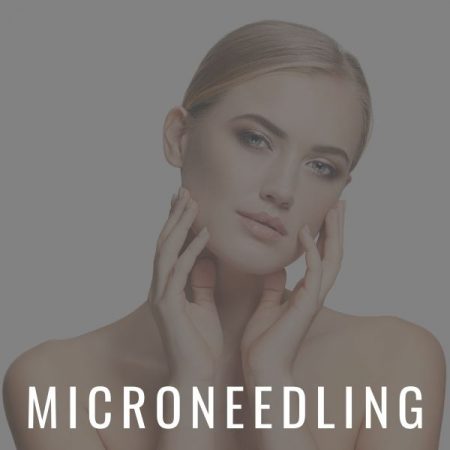 Beautiful woman with clear and firm skin from microneedling at Calista Skin & Laser Center.