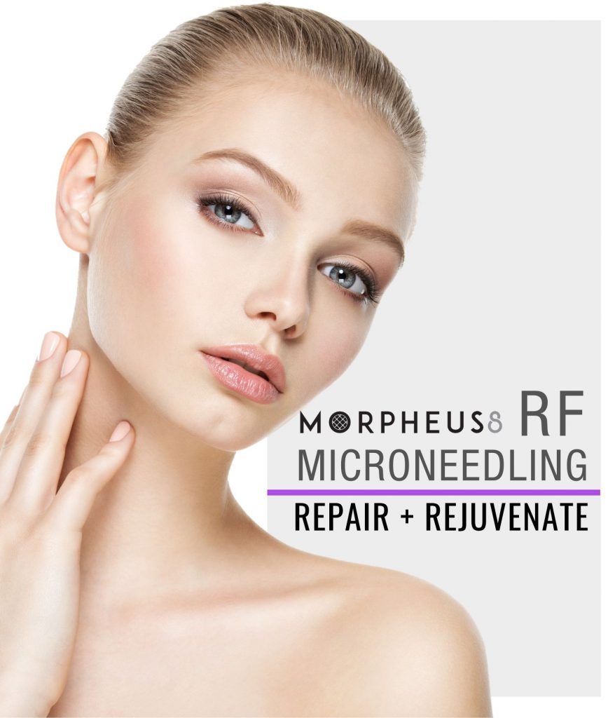 Woman with rejuvenated skin after Morpheus8 RF Microneedling treatment at Calista Laser.