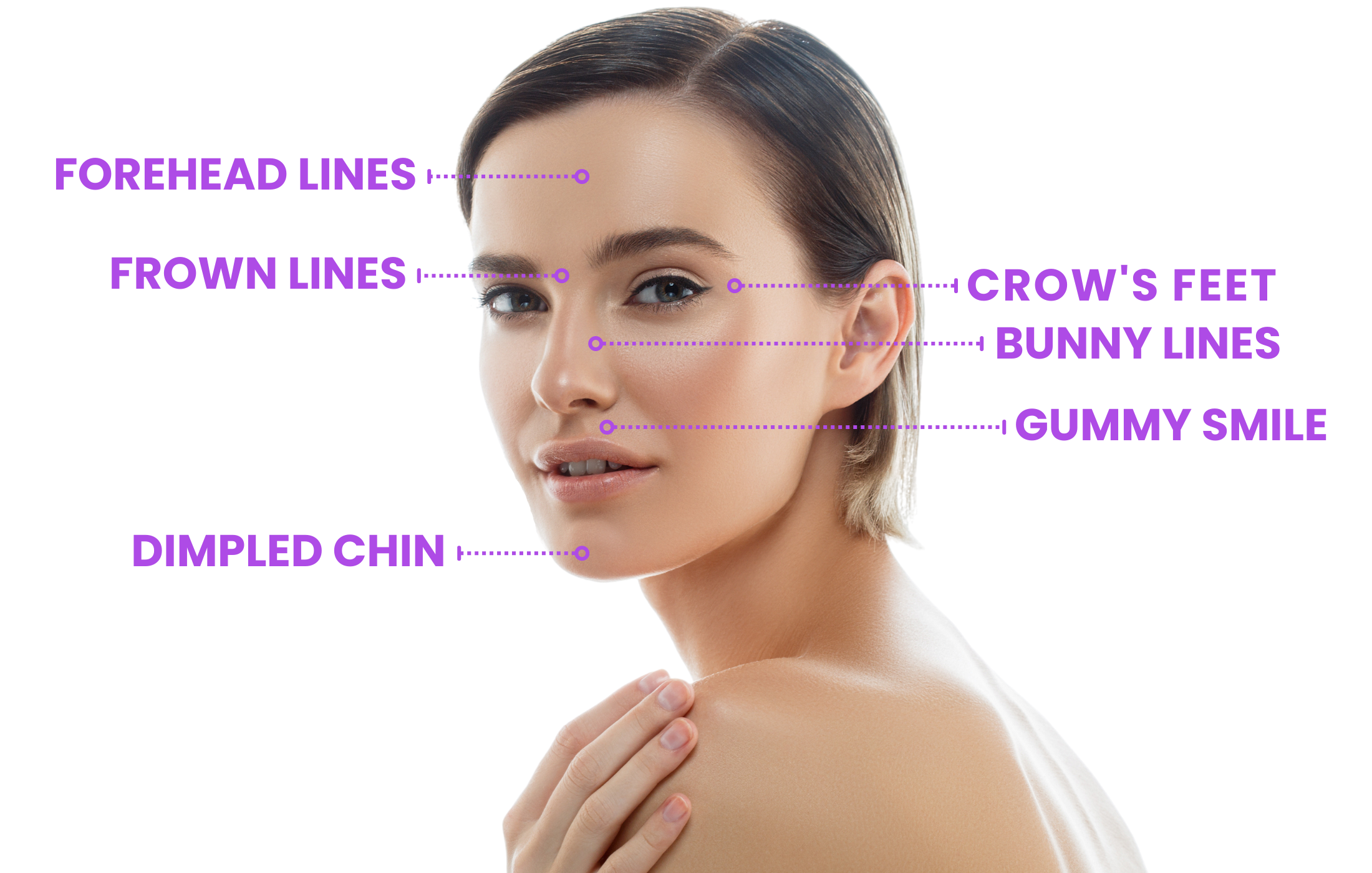 Beautiful woman with perfect skin showing Botox treatment areas in Colleyville, TX.