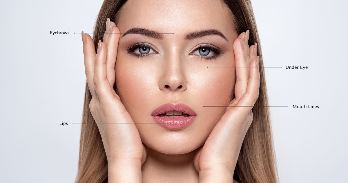 A beautiful face showing the Juvéderm dermal filler areas, a service offered at Calista Skin & Laser Center in Colleyville, TX