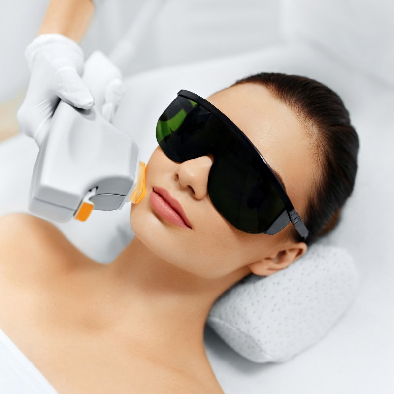 someone getting IPL Photofacial