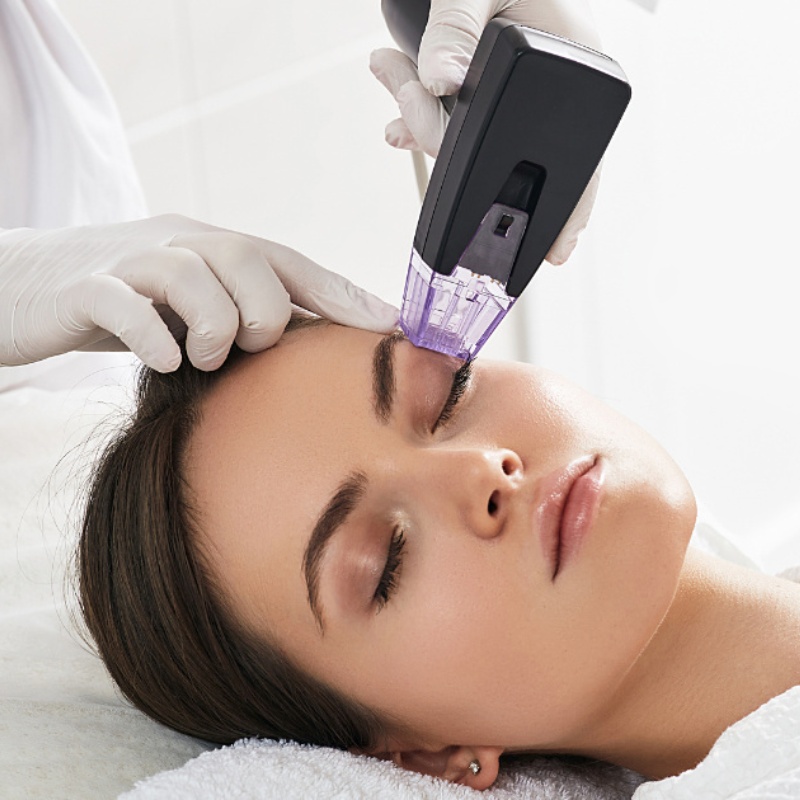 woman getting Morpheus8 treatment