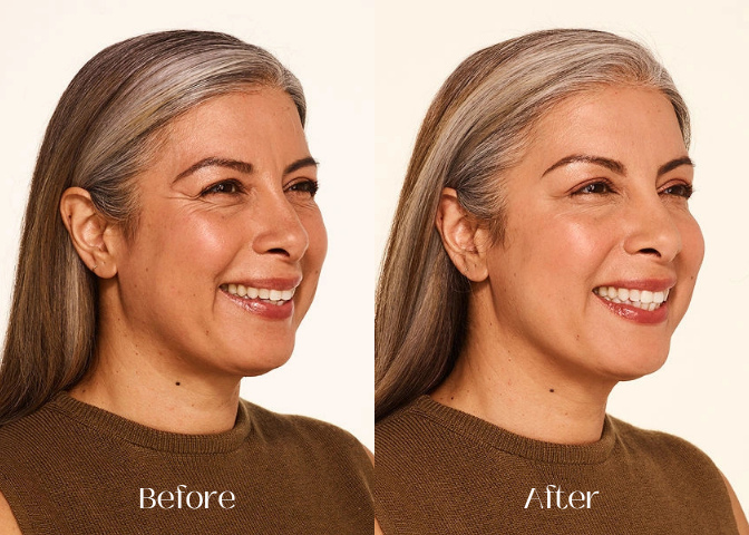 Before and After-1_11zon