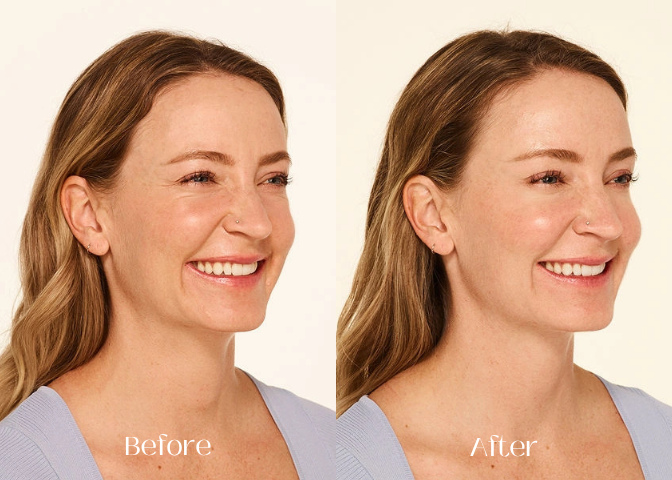 Before and After-3_11zon