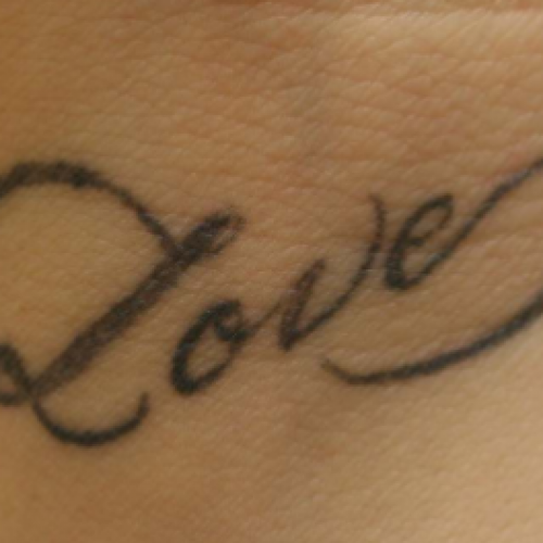 Black ink tattoo of the word Love before laser tattoo removal.